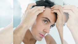 hair loss
